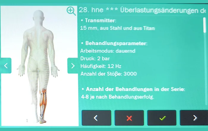 Impactis M + ist ein Stoßwellengerät für Therapeuten - Bild zeigt den grünen Bildschirm mit der Therapieanleitung der Achillessehne - Astar Therapiegeräte