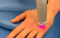 Lasertherapie - Mittelhandknochen Profi-Volleyballer -Astar-Therapiegeräte