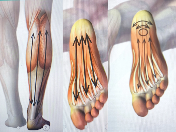 Anatomische Darstellung der Fußsohle mit Plantarfaszie und Behandlungsrichtung bei Ferse